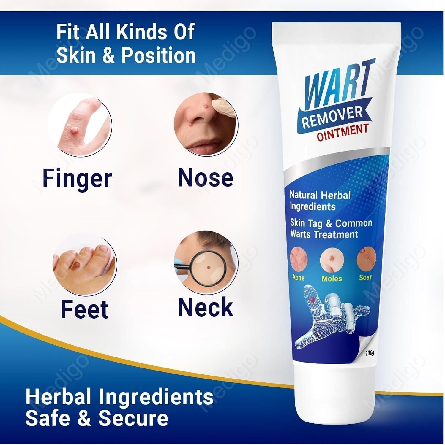 WartsOff Instant Blemish Removal Cream Warts Off Instant Blemish Removal Cream 20 g Wart Remover Ointment for All Skin Types (Pack of 1)