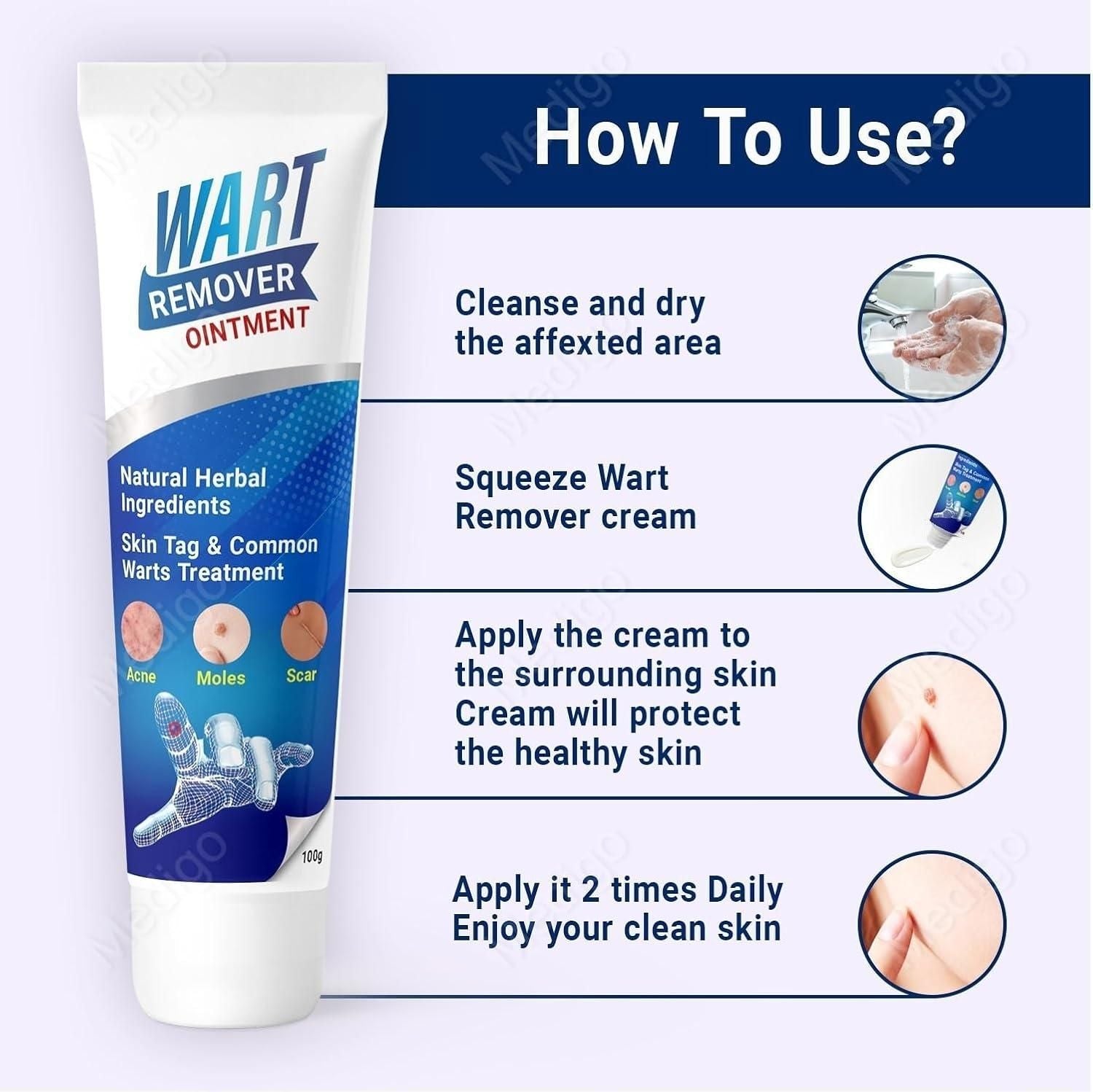 WartsOff Instant Blemish Removal Cream Warts Off Instant Blemish Removal Cream 20 g Wart Remover Ointment for All Skin Types (Pack of 1)